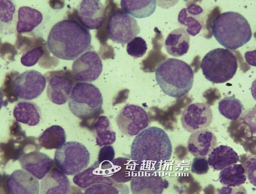 PNAS发现克癌惊人方法:以癌循环肿瘤细胞再