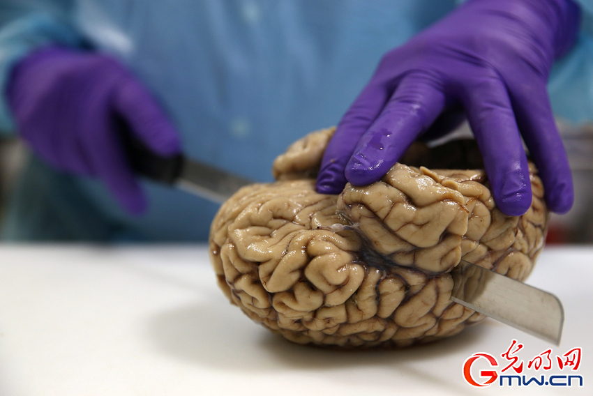 英国大学研究脑神经疾病 科学家切脑如切菜