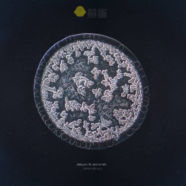 酷摄影:显微镜下的眼泪画像