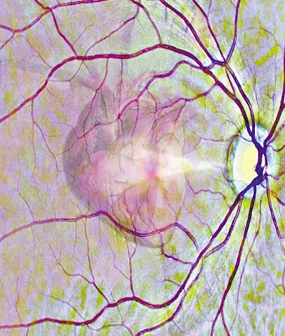 扫描视网膜，AI可知心脏病风险