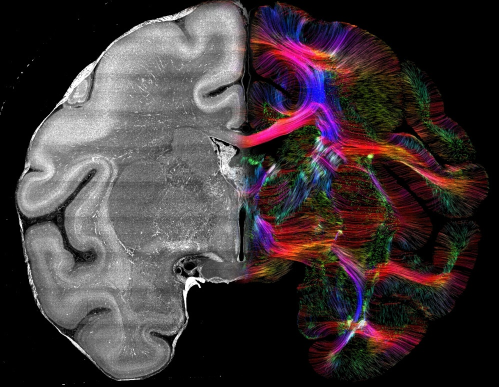 车窗上的雨滴形状 让科学家“画”出了大脑神经纤维地图