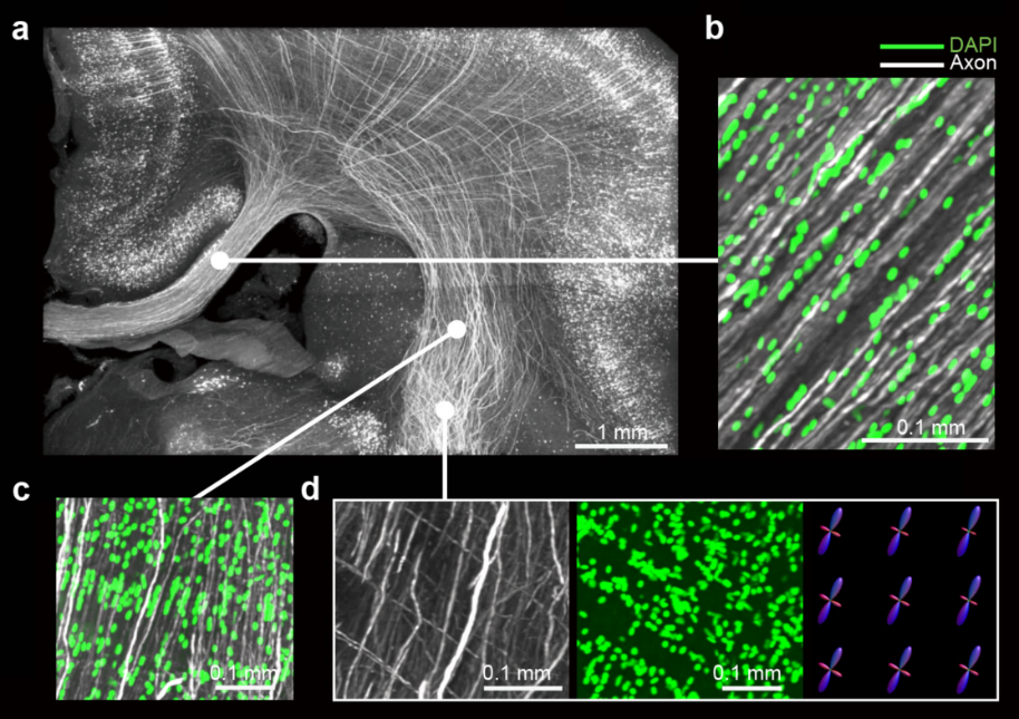车窗上的雨滴形状 让科学家“画”出了大脑神经纤维地图